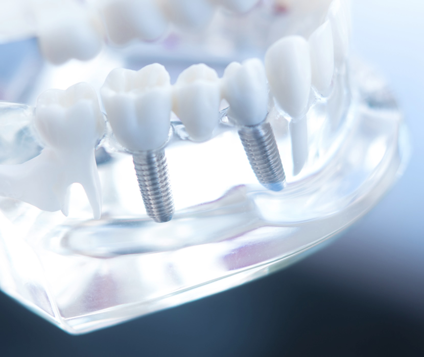 Restorative Dentistry